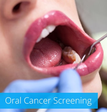 Oral Cancer Screening Bellevue PA